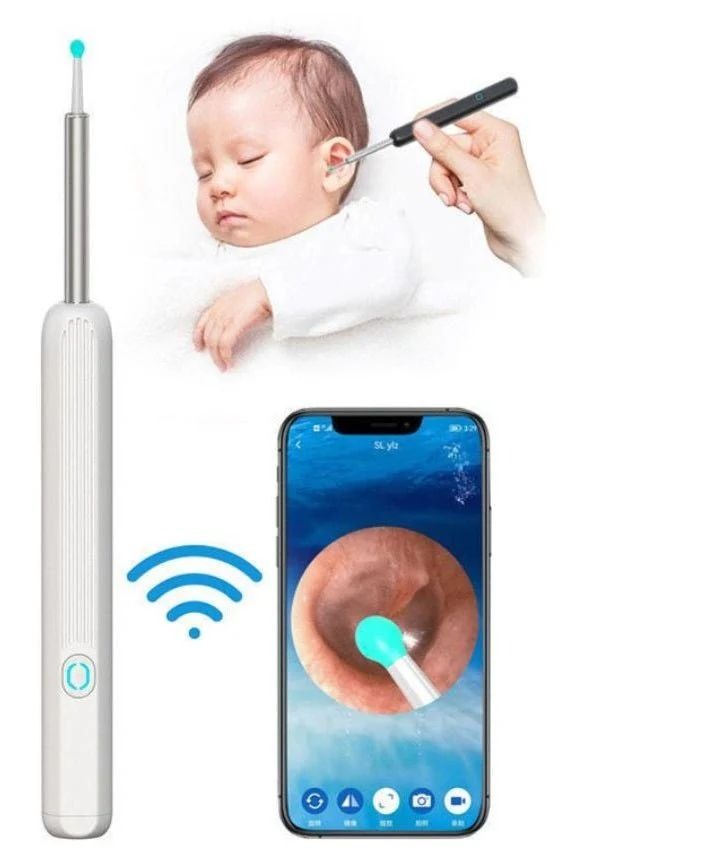 Smart WiFi Ear Cleaner Camera Pen – Baby & Family Safe | تنظيف الأذن الذكي 👶✨