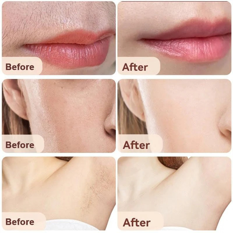 Flawless Mini Facial Hair Remover – Instant Smooth Beauty | مزيل شعر الوجه الأنيق ✨💖