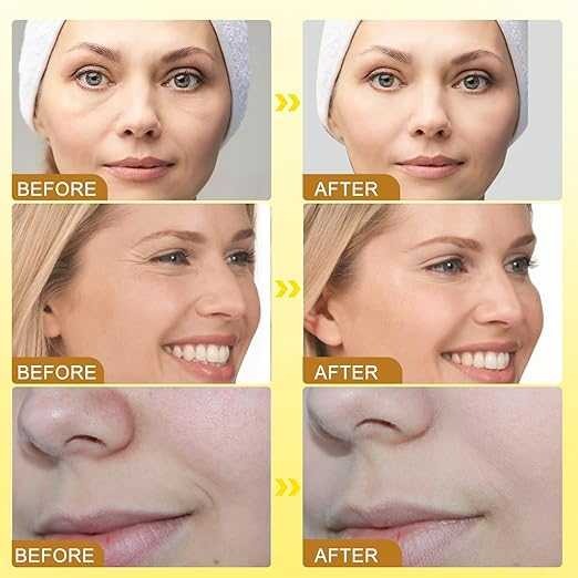 🔥Bee Venom Collagen Boost Cream | Instant Firming & Youthful Glow