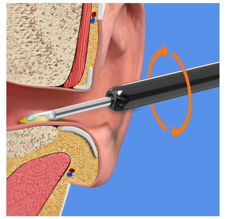 Smart WiFi Ear Cleaner Camera Pen – Baby & Family Safe | تنظيف الأذن الذكي 👶✨